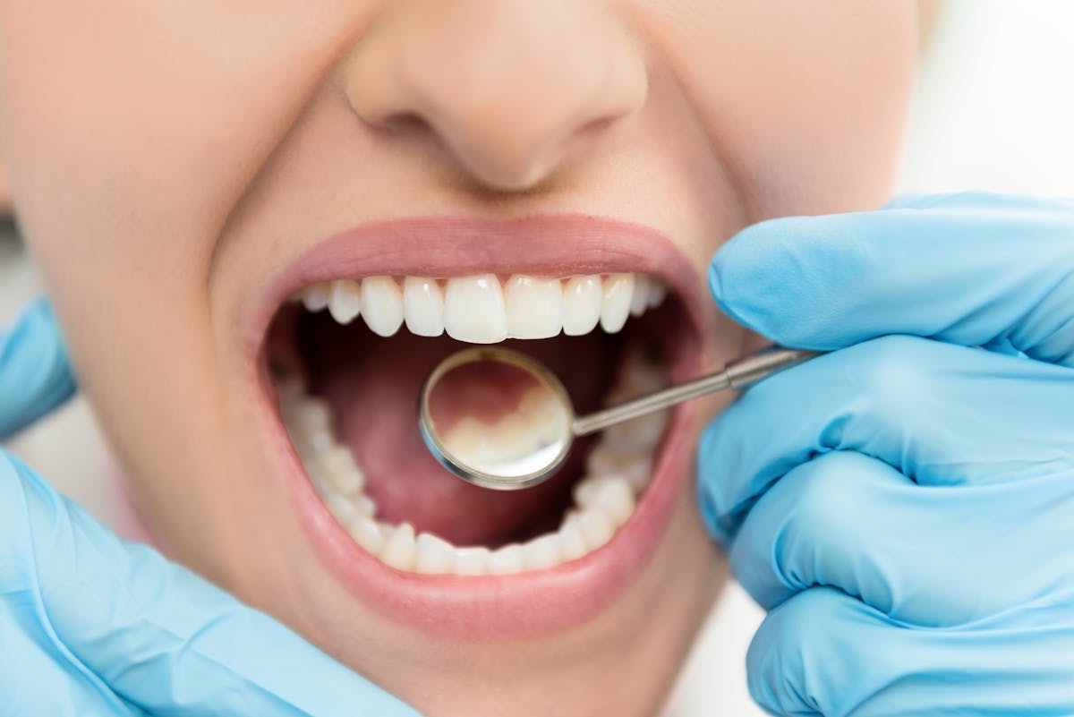 Incisives, mais fragiles : zoom sur les dents les plus exposées